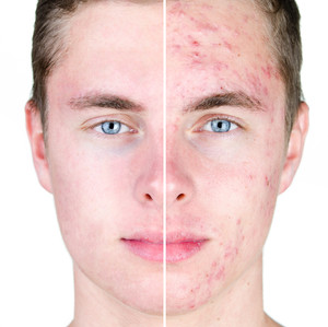 Dermatologische Gesichtsbehandlungen